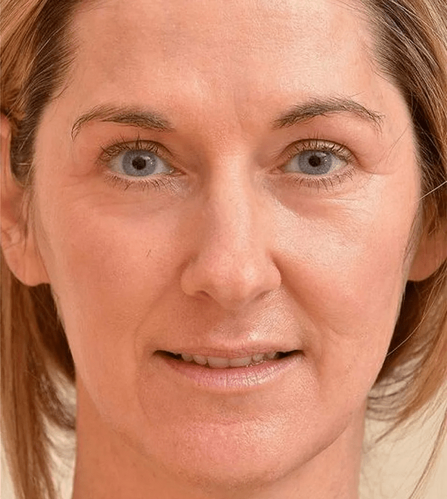 I look younger after applying cream Eudalie