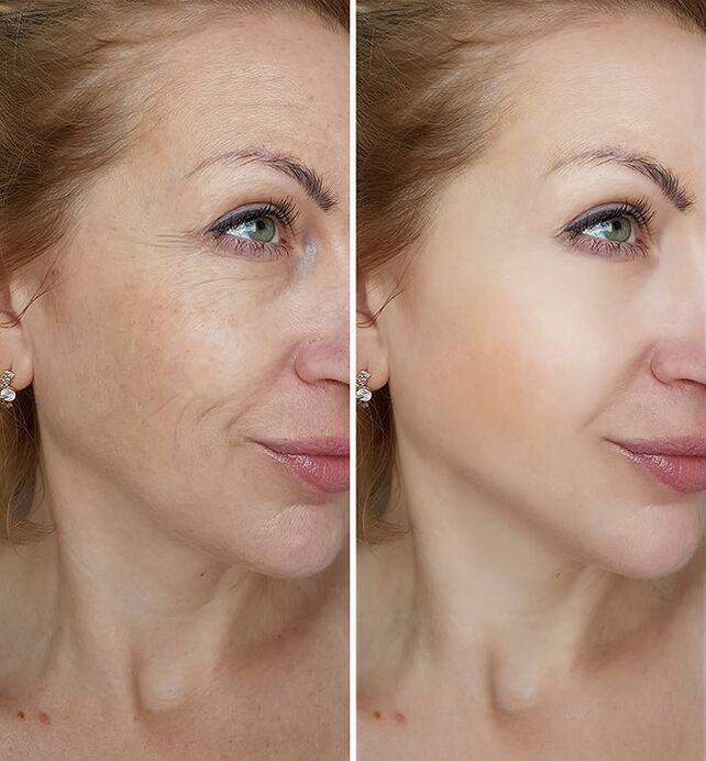 before and after