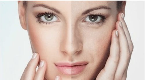 Effective face rejuvenation